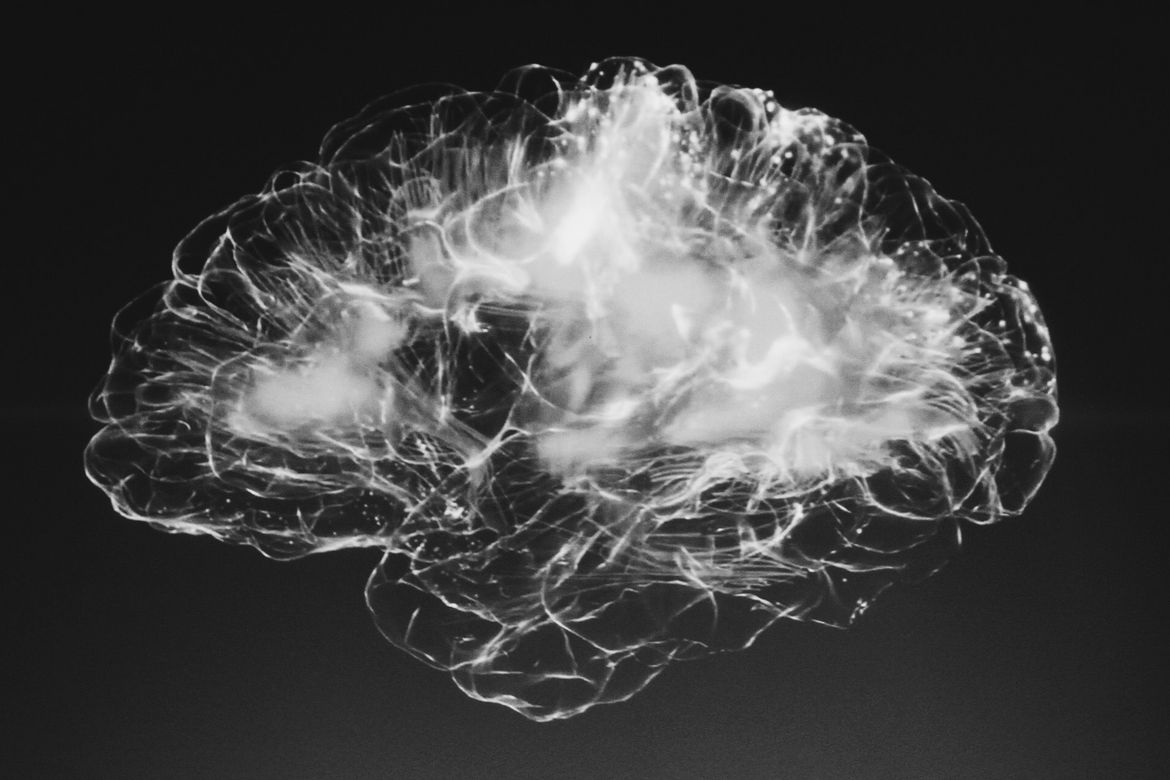 Visualisierung eines Gehirns in schwarz-weiss.