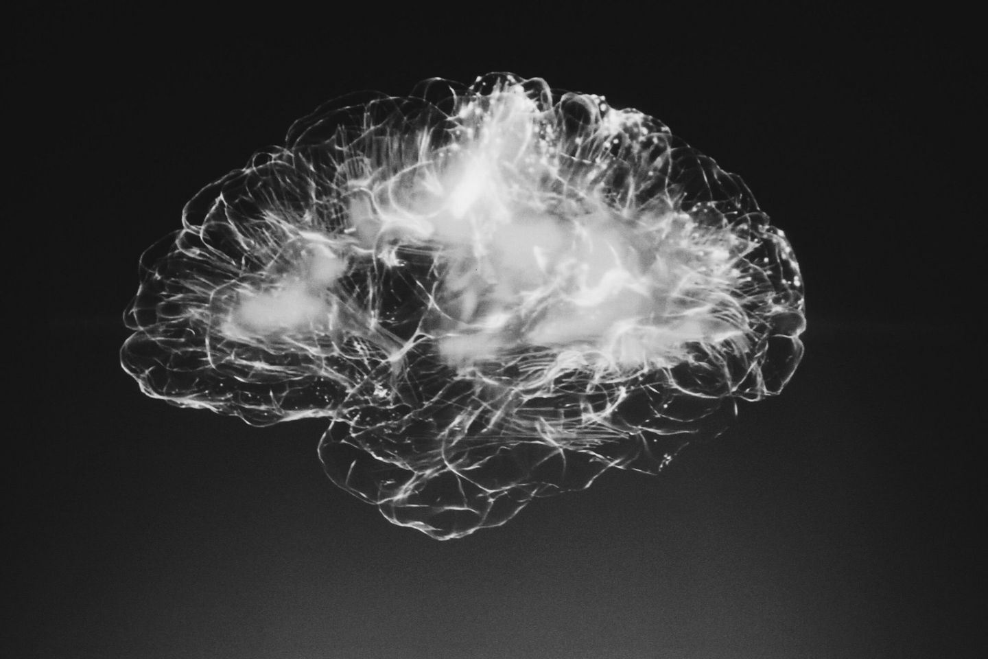 Visualization of a brain.